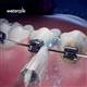 Waterpik Orthodontic Tip – (OD-100E)