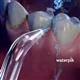 Waterpik Whitening Water Flosser - Precision Tip – (WJT-2E)