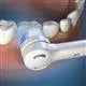 Waterpik Triple Clean Replacement Brush Heads - White – White (OTRB-3WW)